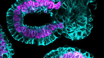 Aus Stammzelllinien (hier von der Maus) können Forscher Gebilde formen, die sich schon fast wie normale Embryonen verhalten und entwickeln.