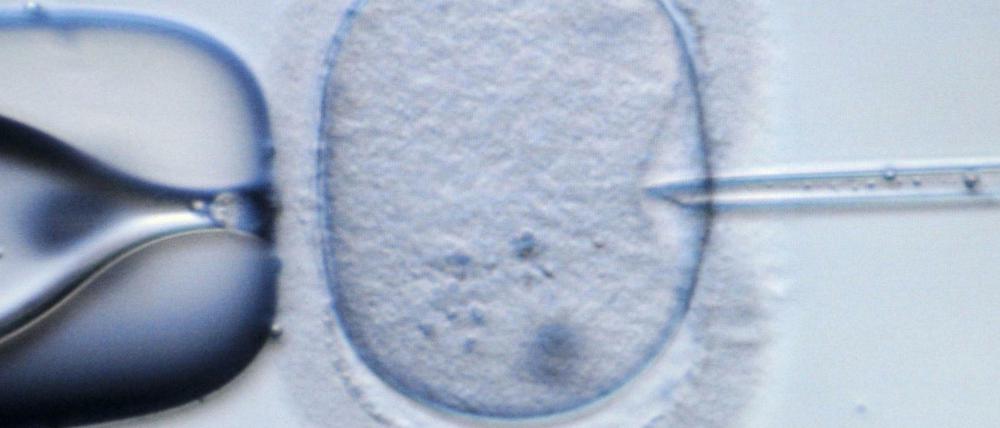 Überzählig. Drei Embryonen dürfen einer Frau bei einer Kinderwunschbehandlung eingesetzt werden. Hergestellt werden jedoch mehr - so dass es zu "überzähligen" Embryonen kommt.