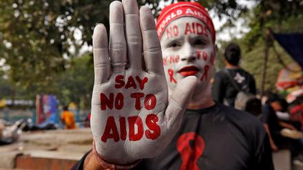 Nein sagen zu Aids können nur Zellen, die den HI-Viren kein Schlupfloch bieten. Jetzt ist es - erst zum zweiten Mal - gelungen, einen HIV-Infizierten mit solch resistenten Zellen von den Aids-Viren zu befreien.