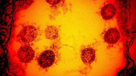 Der Antikörper von Eli Lilly "verklebt" die "Stachel", mit denen Sars-CoV-2-Viren (die kreisförmigen Gebilde in der elektronenmikroskopischen Aufnahme) in die Zellen eindringen.