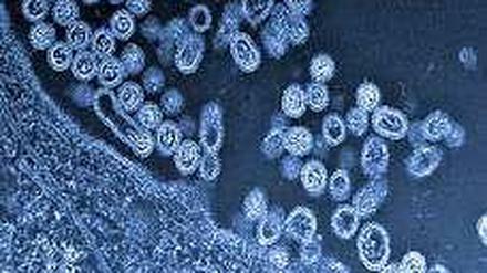 Vogelgrippeviren unter dem Mikroskop.