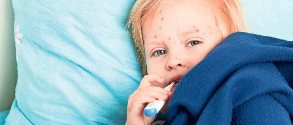 Eine (Kinder-)Krankheit mit Folgen: Auch wer die Windpocken überstanden hat, trägt das Herpesvirus ein Leben lang in sich.