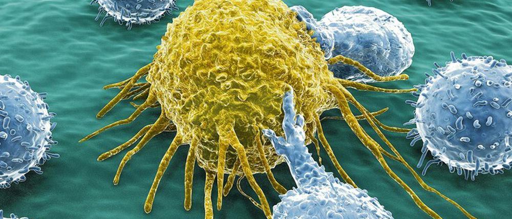 Schonender als Chemotherapie. T-Zellen des Immunsystems (blau) attackieren eine Krebszelle, die bereits Mutationen durchlaufen hat.