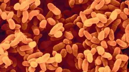 Keimende Gefahr. Bakterien wie diese Kolonie Klebsiella pneumoniae sind immer häufiger gegen fast alle Antibiotika resistent. 