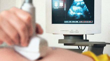 Auf Nummer sicher. Ärzte wollen risikoreiche Tests durch Ultraschall ersetzen.