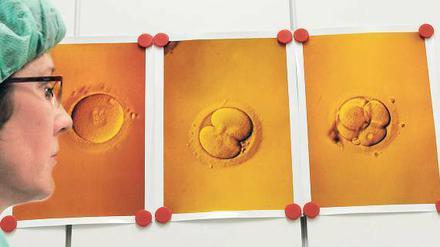 Am Anfang. Eine Laborantin verfolgt das Wachstum eines Embryos in der Petrischale nach künstlicher Befruchtung. 