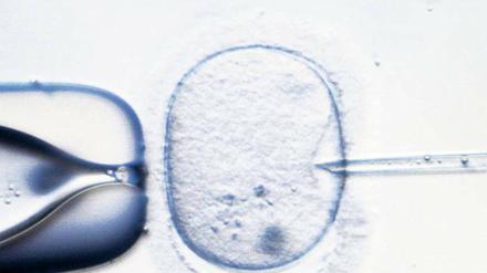 Leben aus dem Labor. Die künstliche Befruchtung ermöglicht es, schwere Erbkrankheiten bereits bei einem Embryo zu erkennen, der nur aus wenigen Zellen besteht. Nach einem entsprechenden Gentest werden nur gesunde Embyronen eingepflanzt.
