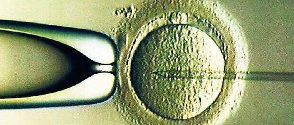 Geschützt. Viele Frauen machen sich zu Unrecht nach einer künstlichen Befruchtung Sorgen, dass persönliche Probleme die Schwangerschaft gefährden. Das Foto zeigt die Befruchtung einer Eizelle (Mitte) mit einer Samenzelle über eine feine Hohlnadel (rechts). Foto: p-a/dpa