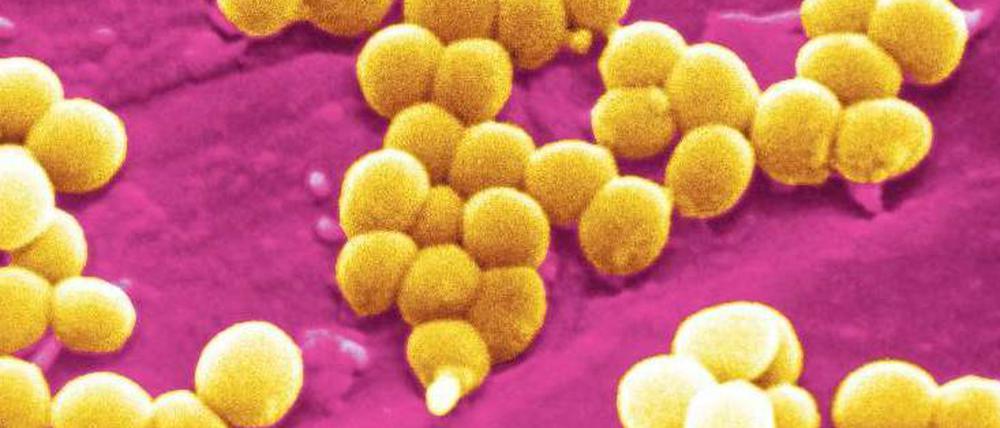 Kugelförmige Staphylokokken leben häufig auf der Haut. Meist sind sie harmlos – und manchmal resistent gegen Antibiotika.