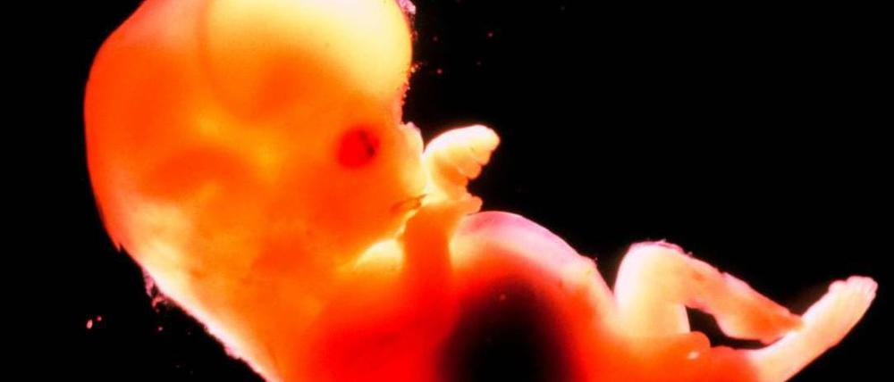 Gesund? Erbgutanalysen von Embryos – hier ein drei Zentimeter großer Fötus in der zwölften Schwangerschaftswoche – könnten künftig anhand des Blutes der Mutter erfolgen. 