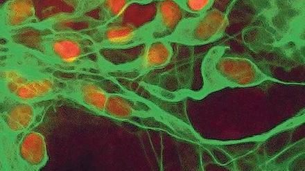 Heilsames Geflecht. Aus Stammzellen gezüchtete Nerven sollen helfen, chronische Krankheiten des Gehirns besser in den Griff zu bekommen. Foto: picture-alliance/dpa