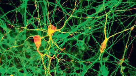 Alles auf Anfang. Gurdon und Yamanaka zeigten an Tieren, dass man erwachsene Zellen zurückprogrammieren kann. Mittlerweile geht das auch beim Menschen. Aus den so gewonnenen Stammzellen können Forscher zum Beispiel neue Nervenzellen züchten. Foto: Reuters