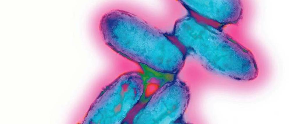 Ein Bakterium, das die Menschheit seit Jahrtausenden heimsucht: Yersinia pestis, der Pest-Erreger.