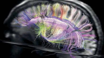 Elegantes Gehirn. Nervenbahnen sind keine wirren Knäuel. Sie verlaufen parallel und bilden ordentliche 3-D-Gitter. 