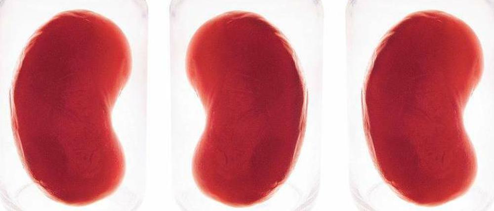 Nachschub an Nieren. Forscher arbeiten daran, Nieren und andere Organe im Labor wachsen zu lassen.