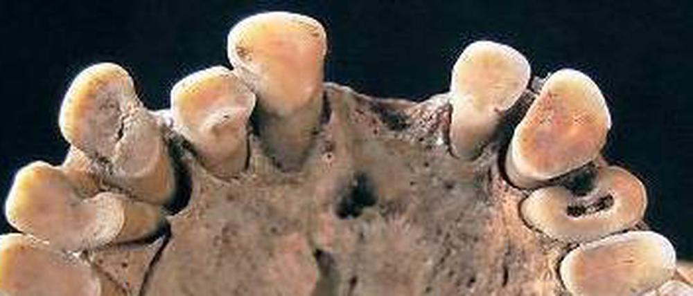 Durchlöchert. Kaum einer der Höhlenbewohner hatte gesunde Zähne. 