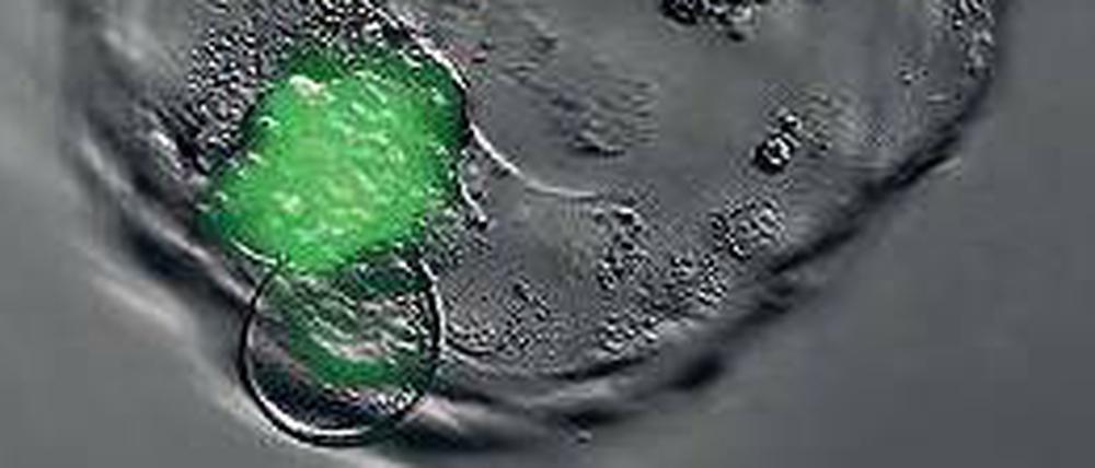 Diabetes geklont. Menschlicher Embryo mit Erbgut (grün) einer Patientin.
