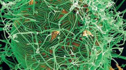 Virenfabrik. Ist eine Zelle (orange koloriert) mit Ebola infiziert, produziert sie am laufenden Band Kopien des fadenförmigen Virus (grün). Eine Zelle nach der nächsten wird so zur Virenfabrik.