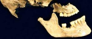 Aus Gebeinen wie dem Zahn eines 7000 Jahre alten Steinzeitschädels, der bei Stuttgart gefunden wurden, haben Forscher die Entwicklungsgeschichte der Europäer rekonstruiert.