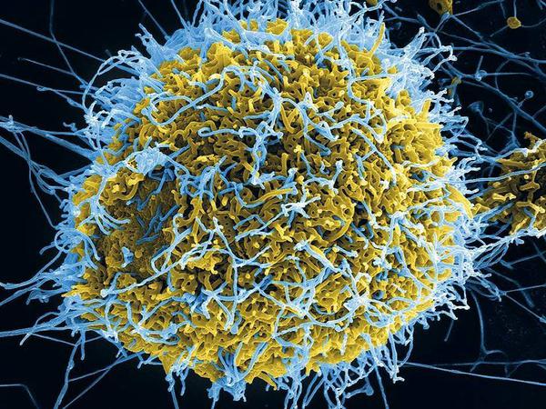 Feindliche Übernahme. Eine infizierte Nierenzelle wird zur Fabrik für Ebola-Viren (im Bild blau eingefärbt).