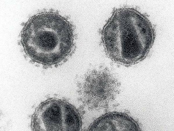 Das Immunschwächevirus HIV (hier in 240 000facher Vergrößerung) ist mit 120 Nanometer Durchmesser etwa 7000 mal kleiner als die Blutzellen, die es befällt.