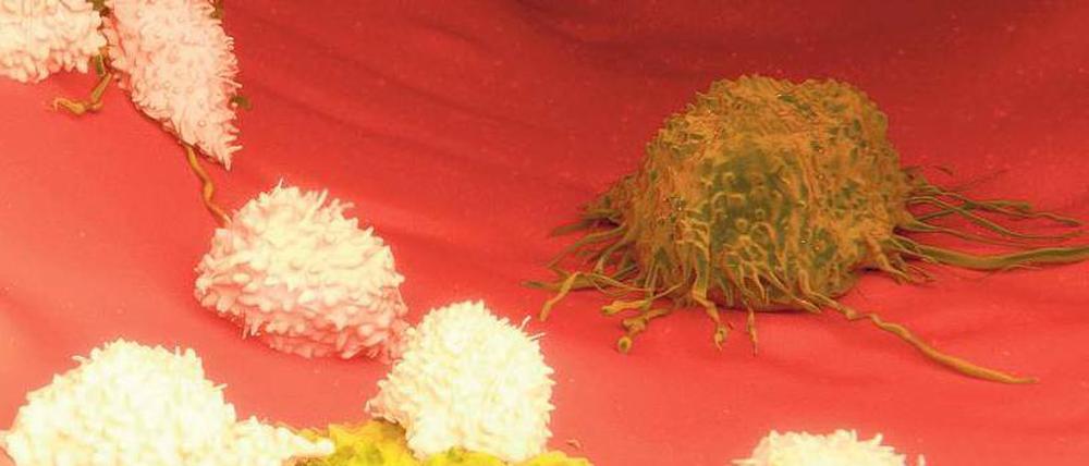 Dem Immunsystem helfen. T-Zellen haben eingebaute molekulare Bremsen. Sie schwächen ihre Angriffskraft. Werden die Bremsen entfernt, können T-Zellen Tumoren besser attackieren. Im Bild greifen T-Zellen (weiß) Krebszellen (gelb) an.