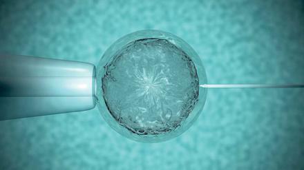 In-vitro-Befruchtung