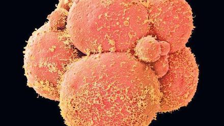 Anfang des Menschen. Die mikroskopische Aufnahme zeigt einen Embryo im Acht-Zell-Stadium.