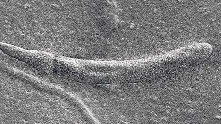 Ein kolbenförmiges versteinertes Spermium des Gürtelwurms in einer mikroskopischen Aufnahme.