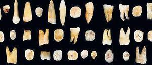 Zahn der Zeit. Aus diesen Fossilien schließen die Forscher, dass Homo sapiens bereits vor 80 000 Jahren China erreicht hatte. 
