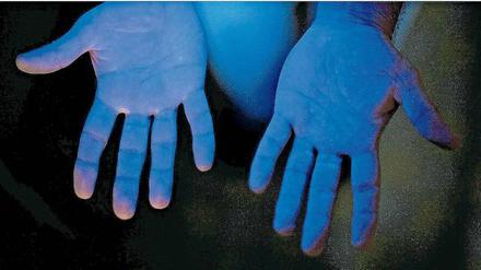 Gründlich. Schwarzlicht offenbart die richtige Händehygiene. Nur sie Stellen, die das Desinfektionsmittel erreicht hat, leuchten blau.