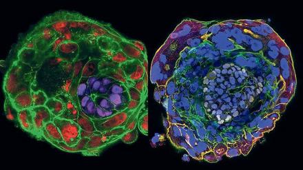 Zu sehen sind zwei unterschiedlich eingefärbte Abbildungen eines in der Petrischale gewachsenen Embryos.