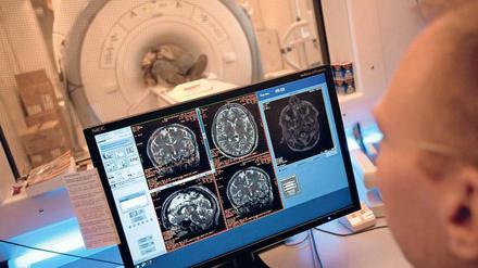 Detaillierter Einblick. Bei modernen Untersuchungen – hier eine Kernspintomografie zur Untersuchung des Gehirns – werden viele Aufnahmen erzeugt. Computerprogramme können helfen, auffällige Veränderungen schneller aufzuspüren. 