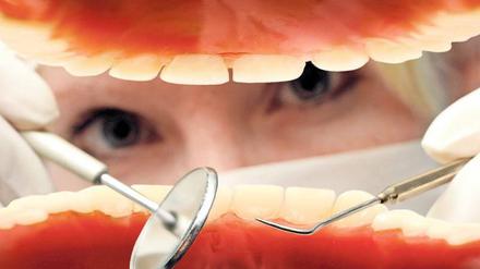 Eine Zahnmedizinerin hantiert mit Spiegel und Haken in einer offenen Mundhöhle.