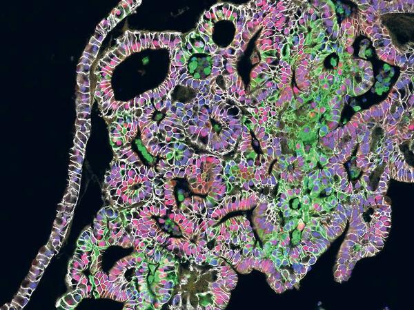 Ersatzgewebe. Der Mini-Magen, den US- Forscher aus menschlichen Stammzellen gezüchtet haben, kann Säure und Verdauungsenzyme produzieren. 