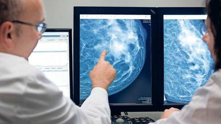 Suche nach dem Krebs. Moderne Mammographie-Geräte machen hochgenaue Aufnahmen. Damit entdeckt man mehr, was wiederum die Entscheidung über das Risiko schwieriger macht.