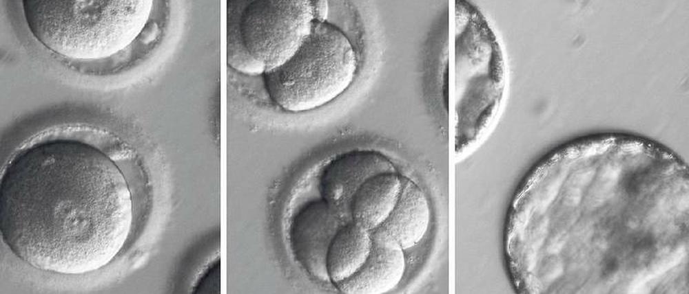 Genetisch verändert. Die Fotos zeigen die Entwicklung von menschlichen Embryonen, deren Erbgut mit der Genschere Crispr/Cas9 korrigiert wurde.