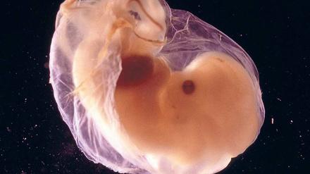 Schützling. In den ersten Wochen der Schwangerschaft sind Embryonen besonders anfällig für Fehlentwicklungen. Leicht geraten Medikamente, die die Mutter in dieser Zeit nimmt, in den Verdacht, der Auslöser dafür zu sein. Nicht immer zu Recht. 