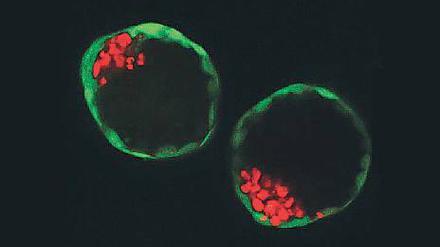 Blastoide - künstlich gezüchtete Blastozysten - ähneln ein Stück weit echten Embryonen. 