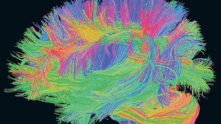 Verbindungen. Im menschlichen Großhirn schwinden mit zunehmendem Alter die Nervenzellen und Verknüpfungen, vor allem im hinteren Bereich (rechts). Was bleibt, vernetzt sich allerdings stärker. Im Bild eine Aufnahme aus dem „1000Brains“-Projekt. 