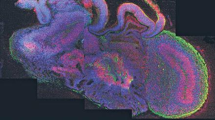 Denkpause. Aus Stammzellen züchten Forscher Mini-Kopien des menschlichen Gehirns. Diese Hirnorganoide (hier vom Wiener Institut für molekulare Biotechnologie) ermöglichen Untersuchungen zum besseren Verständnis des Denkvorgangs. 