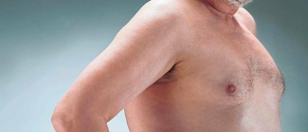 Brustvergrößerung. Bei Männern können die Brüste aufgrund von Hormonschwankungen, Fettleibigkeit aber auch Arznei-Nebenwirkungen über&lt;QA0&gt;die Maßen wachsen.