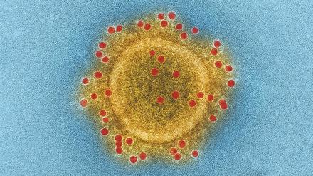 Oberflächlichkeiten. Strukturen außen am Virus (hier MERS, ein dem derzeit problematischen Virus sehr ähnliches) sind entscheidend für die Infektiosität.  