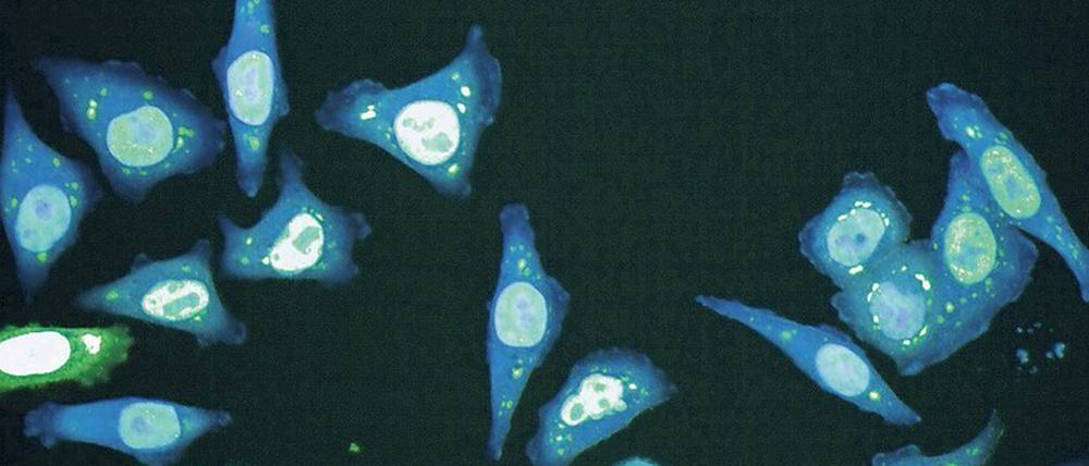 Tropfenfänger. Seit Kurzem erst können Forscher Kondensate, die rätselhaften Pünktchen (hellgrün), die sich in Zellen (blau) bilden und wieder verschwinden, um wichtige Lebensprozesse durchzuführen, mit speziellen fluoreszenzmikroskopischen Methoden beobachten und erforschen. 