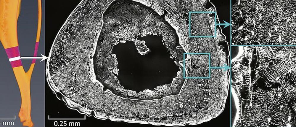 Unter dem Laser-Mikroskop offenbart sich die dichte der Netzwerkarchitektur im Mäuseknochen.
