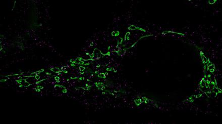 Die für die Zerstückelung von Mitochondrien (grün) verantwortlichen Moleküle sind mit Antikörpern markiert und pink angefärbt.