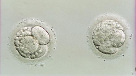 Befruchtet. Vier Tage alte menschliche Embryonen.