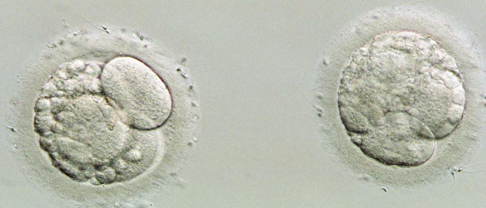 Befruchtet. Vier Tage alte menschliche Embryonen.