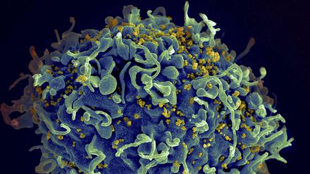 HI-Viren (gelb) befallen vor allem T-Zellen (blau), können ihre Baupläne aber auch ins Genom vieler anderer Zellen schreiben und dort „schlummern“.