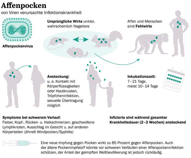 Infografik: Affenpocken, von Viren verursachte Infektionskrankheit